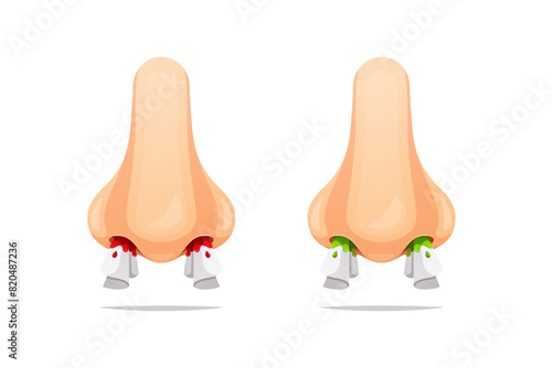 Nose bleeds and runny nose with tissue vector isolated on white background.