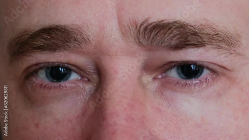 Close-up of a man's gray eyes with dilated big pupils. Eye drops for a visit to an ophthalmologist. Ophthalmological examination and treatment.