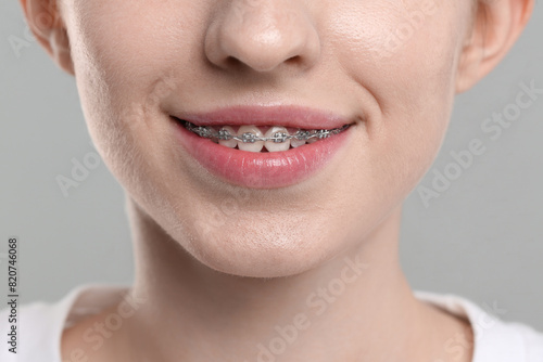 Smiling woman with dental braces on grey background, closeup