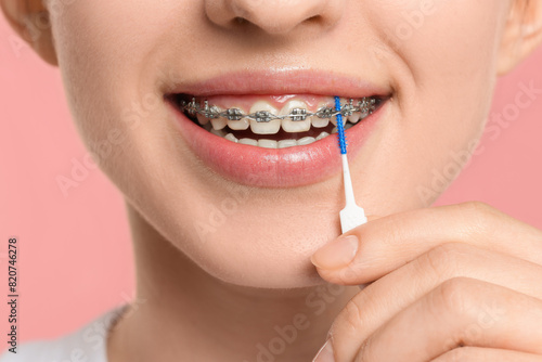Smiling woman with dental braces cleaning teeth using interdental brush on pink background, closeup
