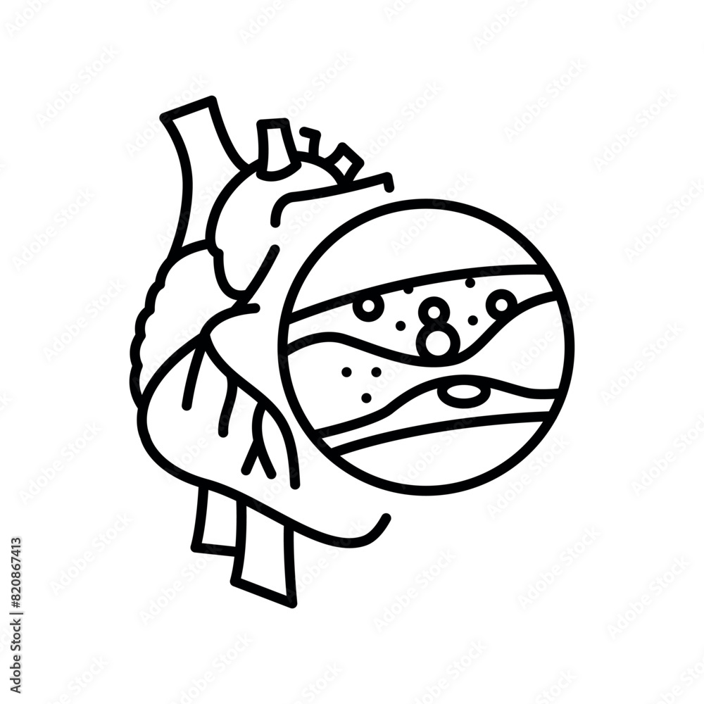 coronary-heart-disease-line-black-icon-human-disease-sign-for-web-page