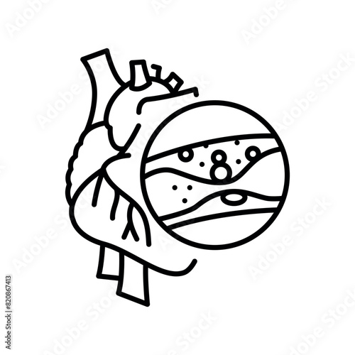 Coronary heart disease line black icon. Human disease sign for web page, mobile app,