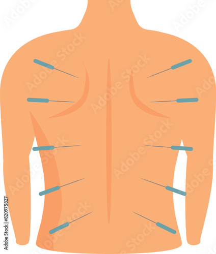 Holistic acupuncture therapy illustration for alternative back pain relief with traditional chinese treatment and therapeutic acupressure