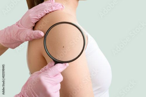 Dermatologist with magnifier examining mole on woman's shoulder against green background, closeup
