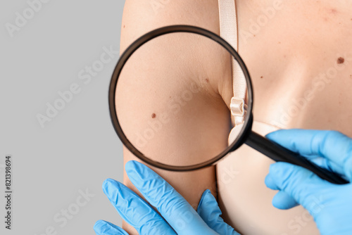 Dermatologist with magnifier examining moles on woman's shoulder against grey background, closeup