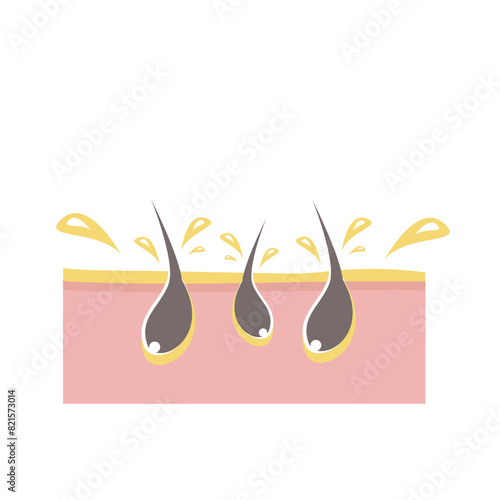 Oily-skin-