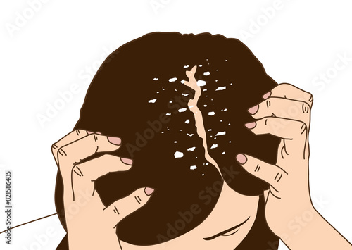 Dandruff on the woman's scalp, illustration on white background