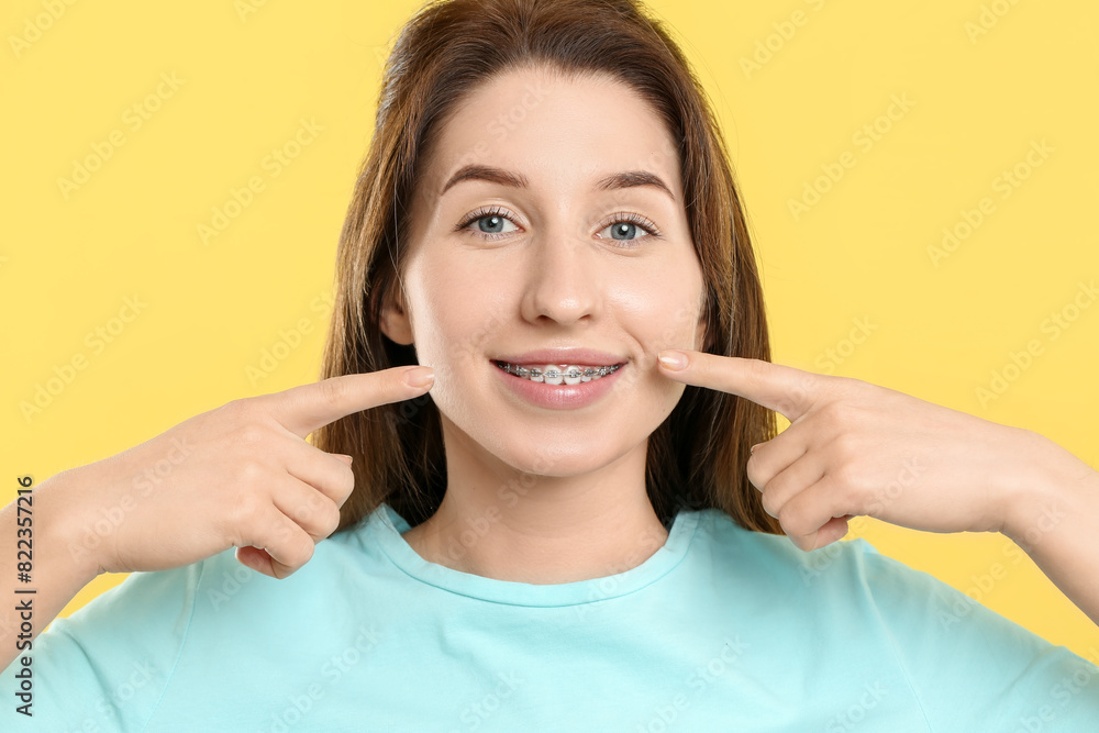 Smiling woman pointing at her dental braces on yellow background Smiling woman pointing at her dental braces on yellow background