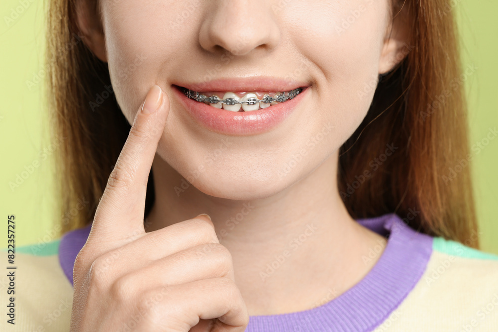 Smiling woman with dental braces on light green background, closeup Smiling woman with dental braces on light green background, closeup