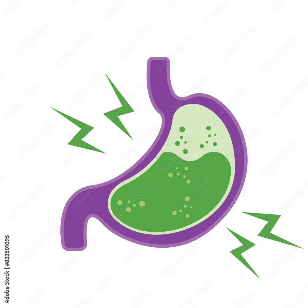 Gastroesophageal reflux disease concept. Human stomach full of gastric acid, cut view. Vector illustration in flat style.