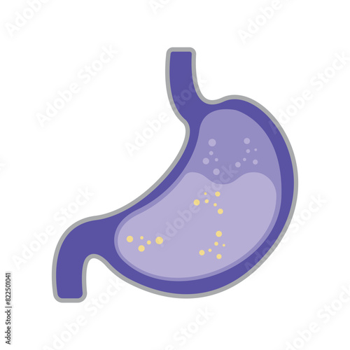 Gastroesophageal reflux disease concept. Human stomach full of gastric acid, cut view. Vector illustration in flat style.