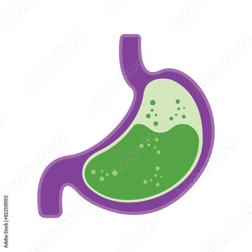 Gastroesophageal reflux disease concept. Human stomach full of gastric acid, cut view. Vector illustration in flat style.