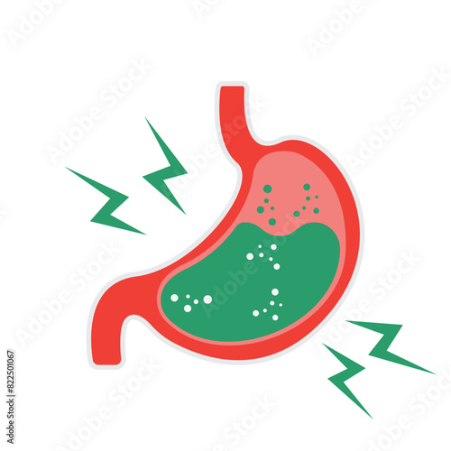 Gastroesophageal reflux disease concept. Human stomach full of gastric acid, cut view. Vector illustration in flat style.