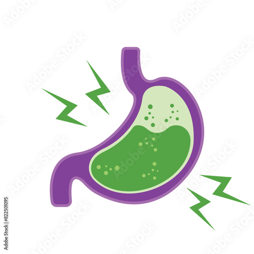 Gastroesophageal reflux disease concept. Human stomach full of gastric acid, cut view. Vector illustration in flat style.