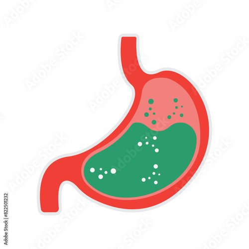 Gastroesophageal reflux disease concept. Human stomach full of gastric acid, cut view. Vector illustration in flat style.