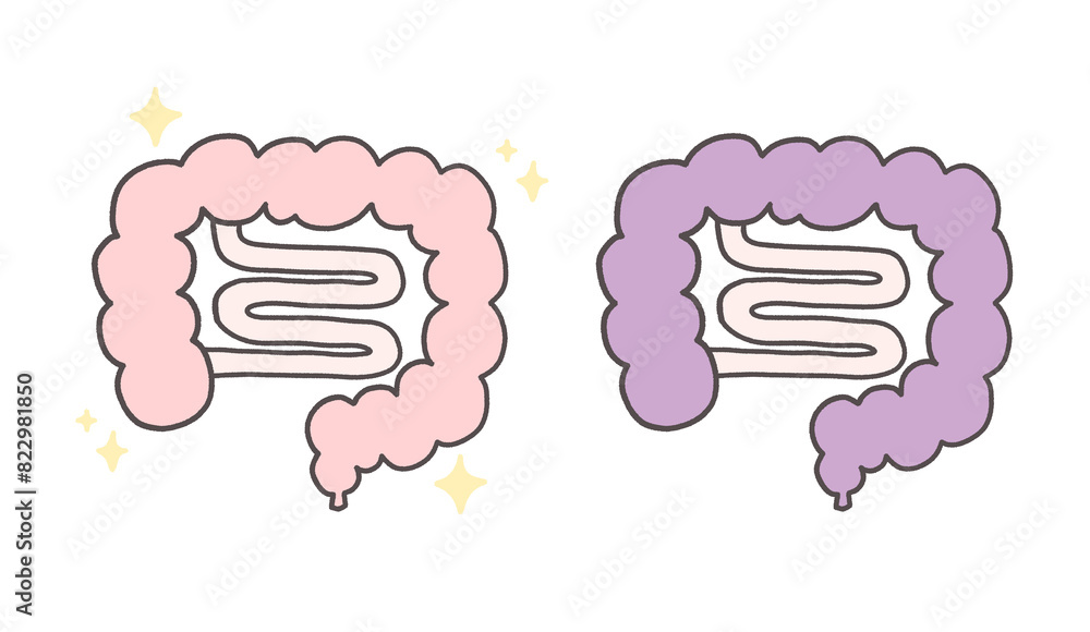 元気な腸と不健康な腸のシンプルなイラスト 元気な腸と不健康な腸のシンプルなイラスト