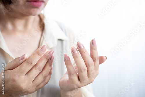 woman suffering from numbness in hand  Carpal tunnel syndrome concept