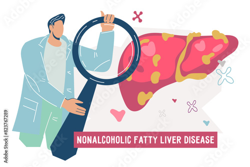 Non-alcoholic fatty liver disease or NAFLD banner for website or presentation, flat vector illustration isolated on white background. Non alcoholic steatohepatitis disease .