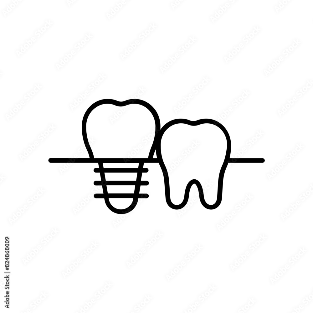 dental implant icon. outline icon dental implant icon. outline icon