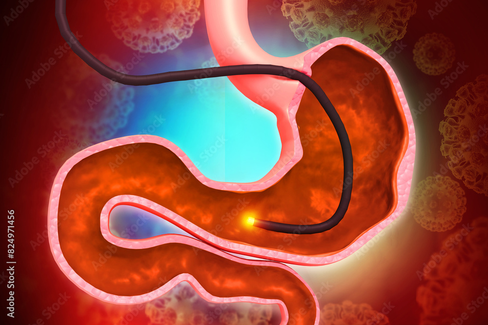 Human Stomach with endoscope and closeup view of bacterium