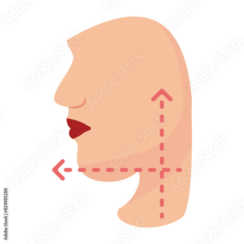 double chin removal concept, get rid of unwanted fat under the chin vector flat design, plastic surgeon Symbol,  body contouring Sign, Beauty treatment stock illustration