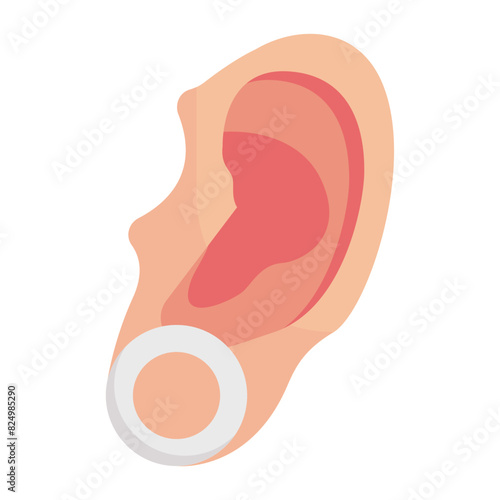 Ear lobe repair surgery concept,  Stitched torn or split earlobe vector flat design, plastic surgeon Symbol,  body contouring Sign, Beauty treatment stock illustration