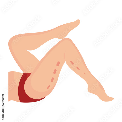 Thigh Lift treatment concept, trim excess fat upper legs vector flat design, plastic surgeon Symbol,  body contouring Sign, Beauty treatment stock illustration