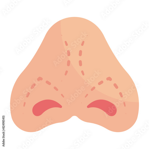 Piggy or Short Over-Rotated Nose concept, Complex Cartilages reconstruction vector flat design, plastic surgeon Symbol,  body contouring Sign, Beauty treatment stock illustrati