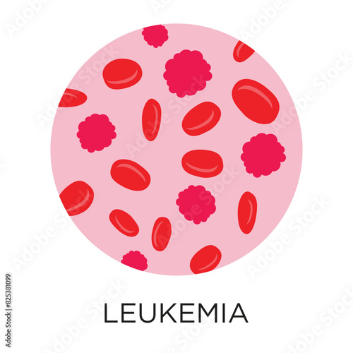 Leukemia flat style vector illustration in circle layout with type, infographic