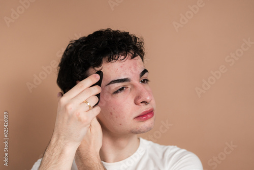 Young man examining acne on his face