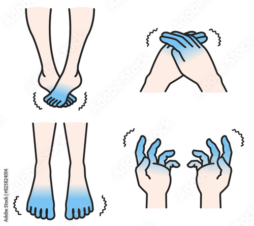 末端が冷える手足のイラストセット