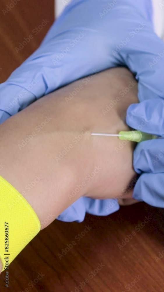 Nurse taking blood samples from a person's hand. Nurse injecting into a patient's han
Enfermera tomando  muestras de sangre  de la mano de una persona. Enfermera inyectando en la mano de un paciente. 
