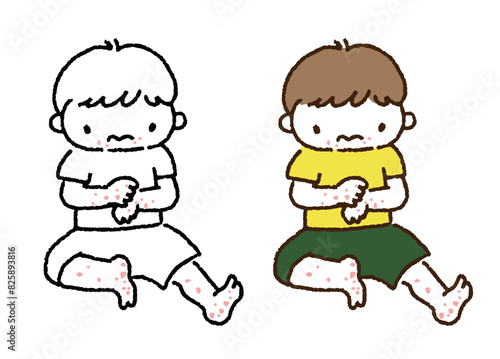 手足に出ている赤い発疹を気にする子供／Illustration of a child concerned about a red rash on his hands and feet