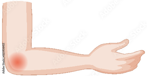 Vector image of an elbow with pain