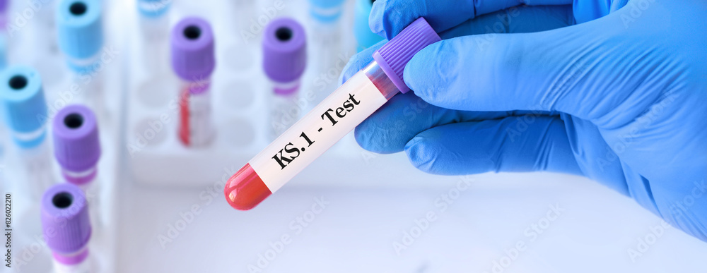 Naklejka premium Doctor holding a test blood sample tube for the detection of the virus KS.1 on the background of medical test tubes. KS.1 one of the FliRT variants. Symptoms with FLiRT are the same as with omicron