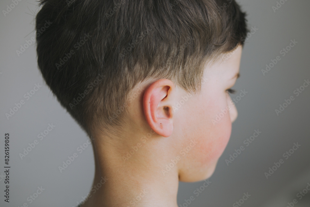 a boy of European appearance with the first signs of the virus, red spots on his face. Allergy on the child's face a boy of European appearance with the first signs of the virus, red spots on his face. Allergy on the child's face