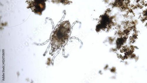 freshwater halacarid mite (Arthropoda of Order Prostigmata Family Halacaridae) from a river under the microscope - light microscope x100 magnification photo