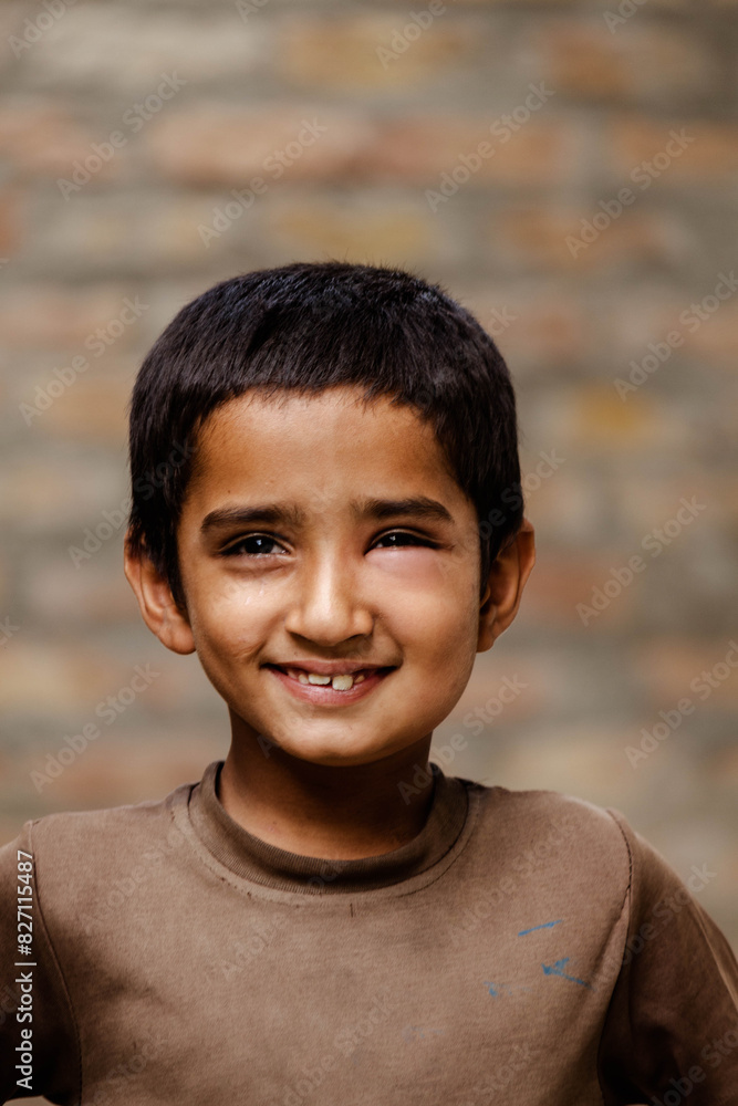 Portrait of a poor staring hungry orphan boy in a refugee camp with a laughing expression on his face Portrait of a poor staring hungry orphan boy in a refugee camp with a laughing expression on his face