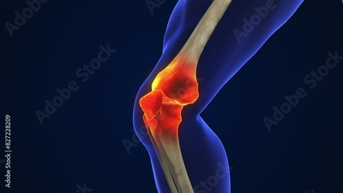 Anatomy Human Knee Joint Treatment, Osteoarthritis Injection