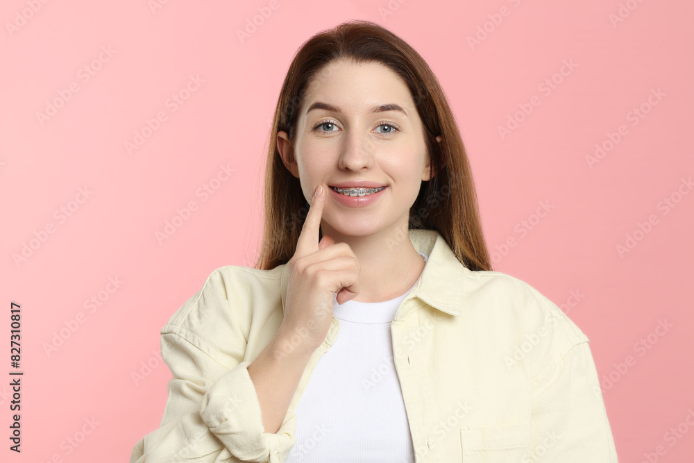 Portrait of smiling woman pointing at her dental braces on pink background Portrait of smiling woman pointing at her dental braces on pink background