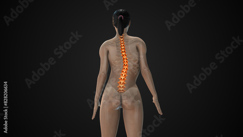 Scoliosis of the spine medical condition