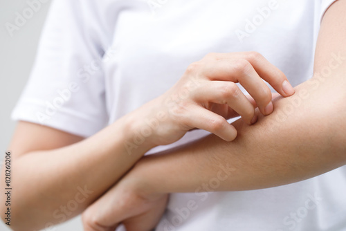 Cuadro en lienzo Health problems, woman has itchy hands