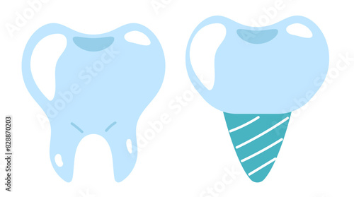 Healthy tooth and implant isolated concept. Vector flat graphic design illustration