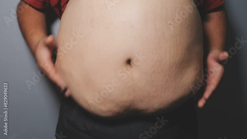 Wallpaper Mural Overweight man's belly,fat man has excess fat, he is dieting and losing weight.unhealthy,medical health concept with copy space space for text Torontodigital.ca