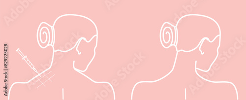 Woman's neck from behind before and after botulinum toxin. Vector illustration