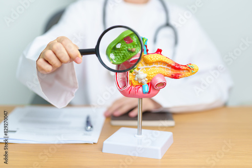 Doctor with human Pancreatitis anatomy model with Pancreas, Gallbladder, Bile Duct, Duodenum, Small intestine and magnifying glass. Pancreatic cancer, acute pancreatitis and Digestive system