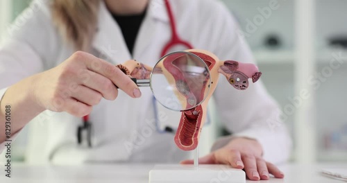Doctor with anatomy model of the uterus and ovaries and a magnifying glass photo