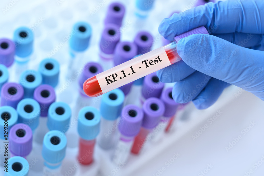 Naklejka premium Doctor holding a test blood sample tube for the detection of the virus KP.1.1 on the background of medical test tubes. KP.1.1 , one of the FliRT variants. 