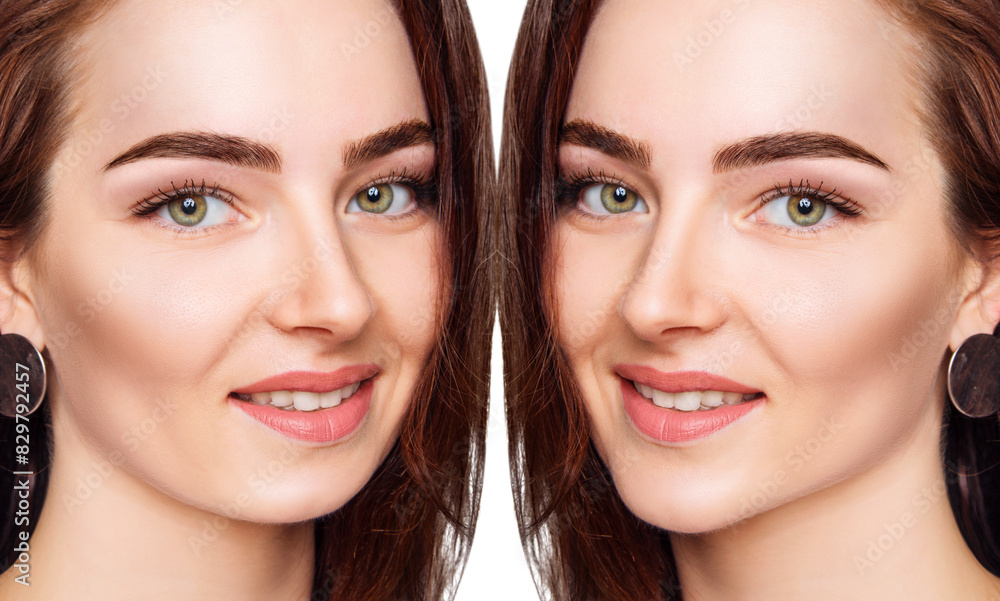 Young woman before and after chin correction. Over white background. Young woman before and after chin correction. Over white background.