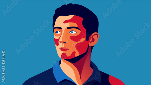 A painting of a man with a prominent birthmark on his face exuding confidence and owning his imperfection.. Vector illustration